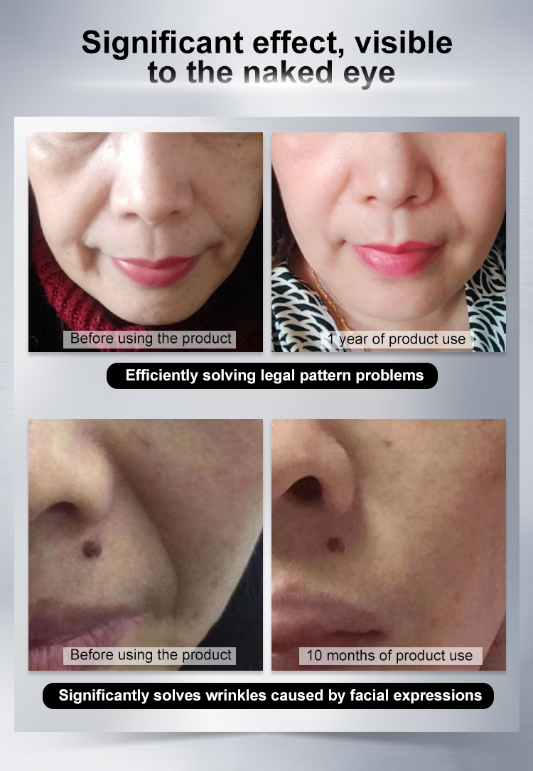 Anti Wrinkle V Face Lifting Strips Serum