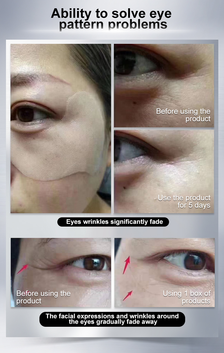 Anti-wrinkle Repair Eye patch price-China